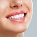 Teeth Whitening Treatment Cost